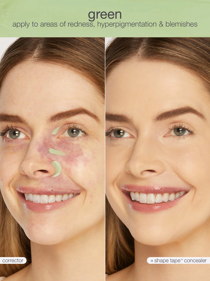 shape tape™ corrector