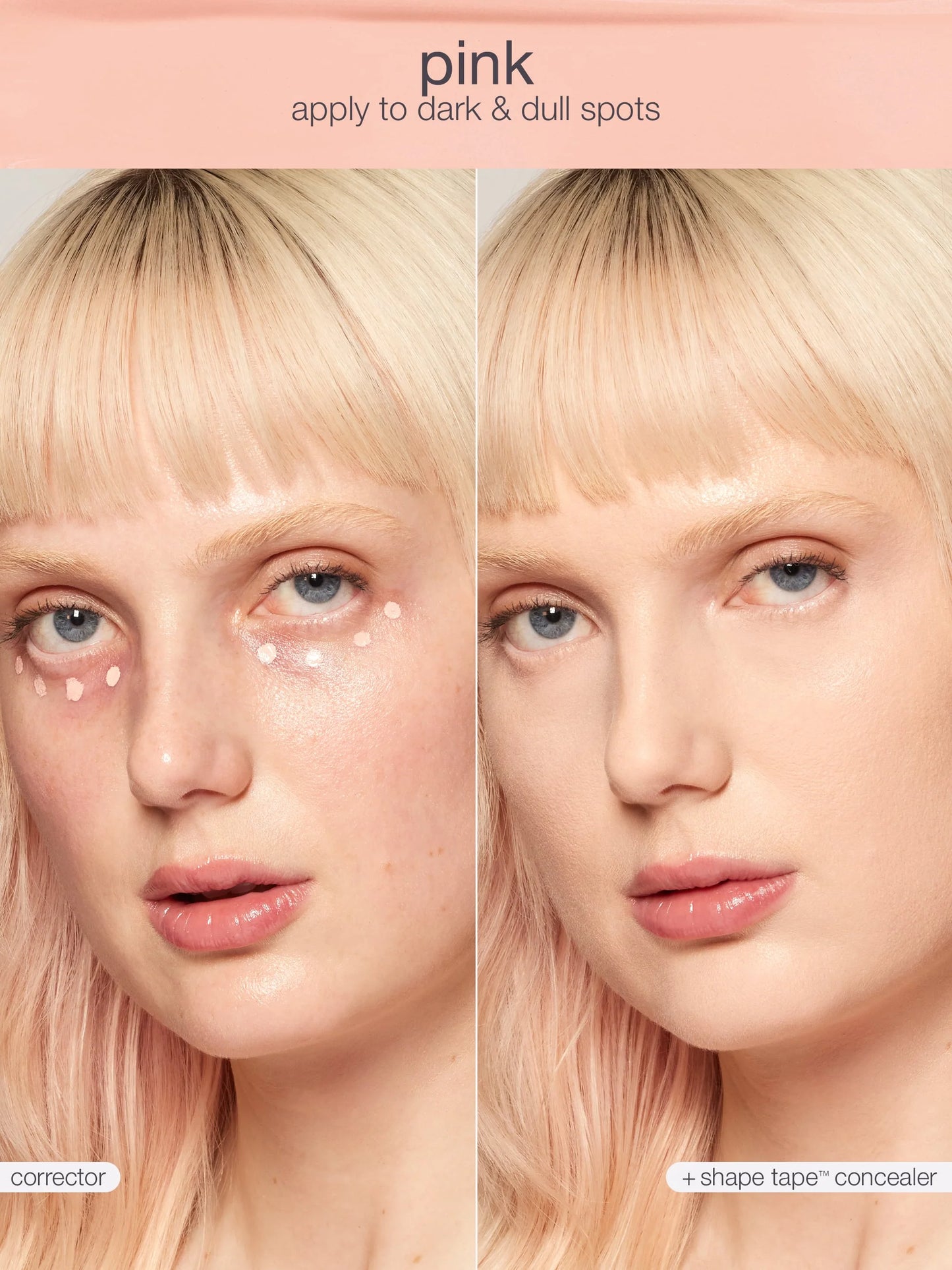 shape tape™ corrector